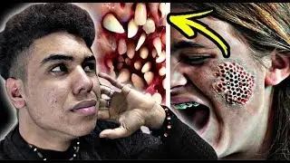 أتحداك أن تكمل الفيديو بدون أن تحس بالقشعريرة 😱(أخطر فوبيا في العالم - trypophobie🔥)