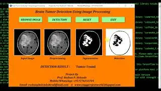 Python Code On Brain Tumor Classification Using Image Processing Python Project With Source Code