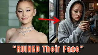 7 Hollywood Stars Who Destroyed Their Faces Chasing a Beauty Trend