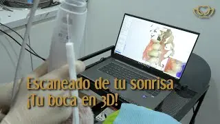 💻Procedimiento de escaneo dental 3D, mediante escáner intraoral 💥