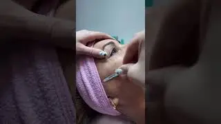 Dermaplaning!