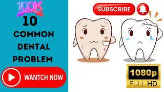 10 Common Dental Problem Causes Symptom & Treatment # Causes Of Dental problem📢📢📢📢