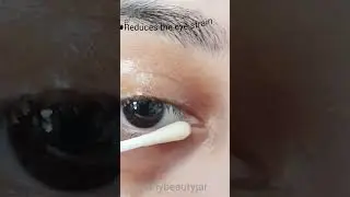 Tired eyes remedies #tiredeyes #homeremedies #diy