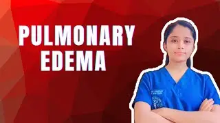 Pulmonary Edema Made Easy | Cardiogenic vs Non-Cardiogenic