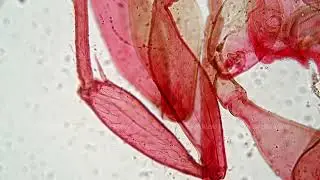 Microscopic footage of an ant whole mount magnified in 400 times filmed on bright field background