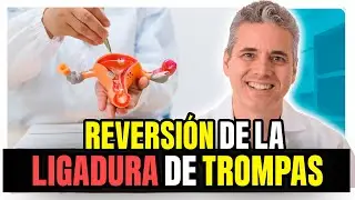 Reversión de la ligadura de trompas: ¿es posible? - Dr. Juan Luis Giraldo