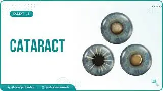 5. Cataract 👁️ Introduction, Types, Location & Structural Classification ( Part -1)