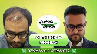 After a hair transplant implanting is Finasteride safe to use?