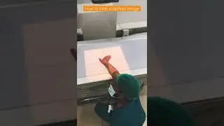 Scaphoid view Xray. How to take scaphoid view xray.