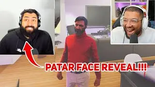 MC Fixer Reacts to Patar's Face Reveal