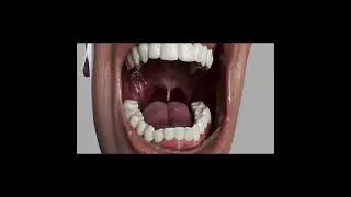 3D Texturing Insidemouth