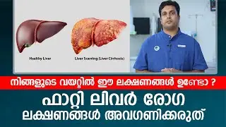 നിങ്ങളുടെ വയറ്റിൽ ഈ ലക്ഷണങ്ങൾ ഉണ്ടോ | Fatty Liver രോഗ ലക്ഷണങ്ങൾ അവഗണിക്കരുത്