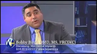 Mini-Dental Implants with Vancouver Dentist Bobby Birdi, DMD