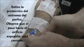 Manejo de la llave de tres vías