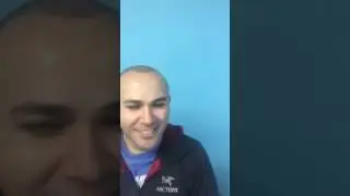 Touch Up Hair Transplant for Perfect Hairline