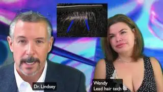 Another younger hair transplant in DC by Dr. Lindsey | McLean | Virginia | Maryland | Washington
