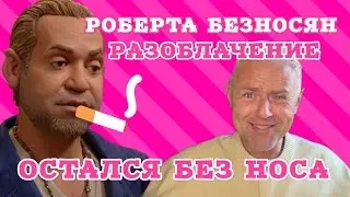 Шок! Операцию на нос Робертиньё делал у стоматолога. Прокурил нос после хирургии. 