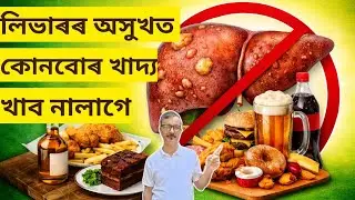 Worst Foods for Liver Disease | Avoid These Immediately | Good Health Assamese 