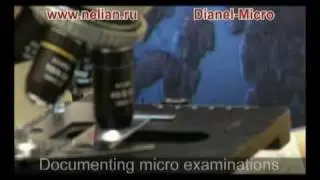 Dianel-Micro - digital microscopes software for visualization of live blood analysis - hemoscaning