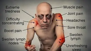 Chronic Fatigue Symptoms That Are Not Normal