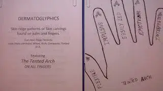203 THE TENTED ARCH ON ALL FINGERS??!!