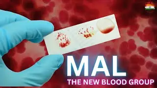 MAL Group Revolutionizes Medical History with Rare Blood Breakthrough