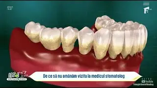 CE SE POATE ÎNTÂMPLA DACĂ AMÂNĂM VIZITA LA MEDICUL STOMATOLOG? - Dr. Cazacu Corrado
