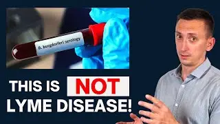 The Problem With Lyme Disease