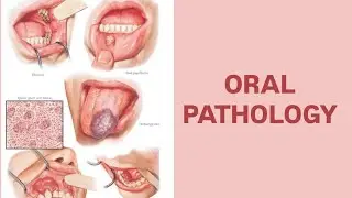 Genetic, metabolic and other non-neoplastic bone diseases | part 1
