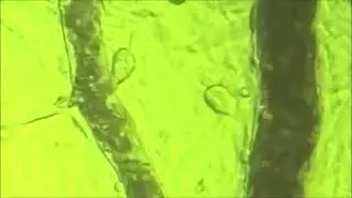 The Effect of BEMER