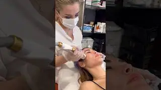 Frozen Face; cildi gen&ccedil;leştirmek, sıkılaştırmak, lekeleri gidermek i&ccedil;in uygulanan işlemdir.