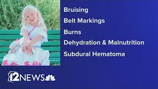 10-year-old girl's death in AZ prompts DCS investigation
