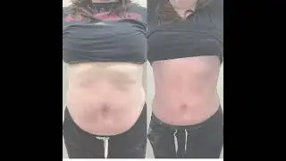 Cryo Slmming Incredible Before After Video