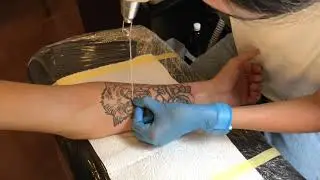 Лазерное удаление тату, 1й сеанс ( instagram мастера kisha.tattoo )