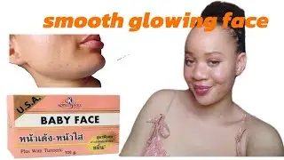 Baby Face Soap with tumeric Review for Acne | Does It Really Clear Pimples? 🔥
