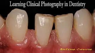 Learning Clinical Photography in Dentistry