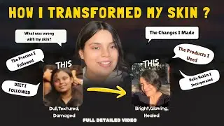 How I TRANSFORMED My Skin | Full Detailed Process + Products + Diet #skincare #skincareroutine