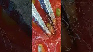 Juicy Strawberry Seed in Macroextended clip #ASMRExperience #SatisfyingVideo #CloseupCapture #ZoomIn