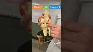 Сухожилие против связки
