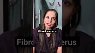 #shortvideo #fibroids #uterus #viral #shorts #drmanishamehta