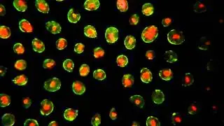 Haematococcus in Darkfield
