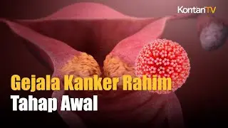Perempuan Harus Tahu, Gejala Kanker Rahim Tahap Awal