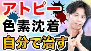 アトピーの色素沈着は自力を治す方法とその限界