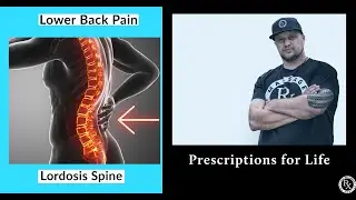 Lower Back Massage - Best Techniques For Lordosis. Part 1 | Life Rx Los Angeles