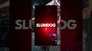 Slumdog Interview