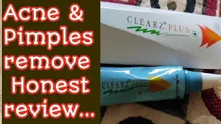 Honestly review || CLEARZ PLUS CREAM || Acne & Pimples mark remove ||100% Work ||