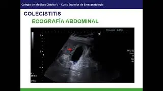Colecistitis y colangitis, Curso superior de Emergencias 2023