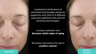 B&AS HYLA SERUM | Jan Marini