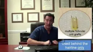Dr. Brett Bolton How Much Does a Hair Transplant Cost ?