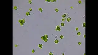 Potential Filasteria, Kraken, or other Cercozoa - Pt. 2